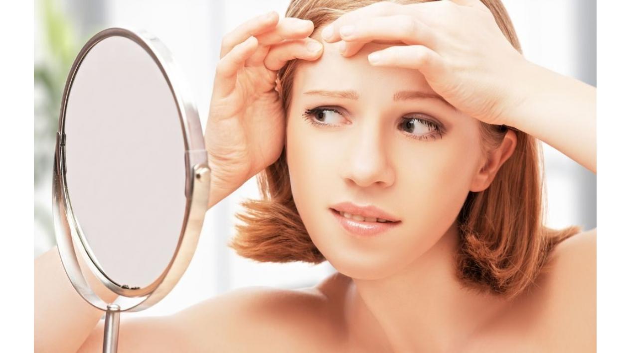 4 Lucruri pe care trebuie sa le cunosti despre acnee