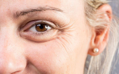 Ce zic ridurile despre tine și starea ta de sănătate