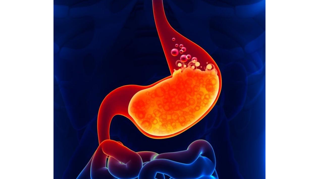 Simptomele care te ajuta sa recunosti ulcerul duodenal